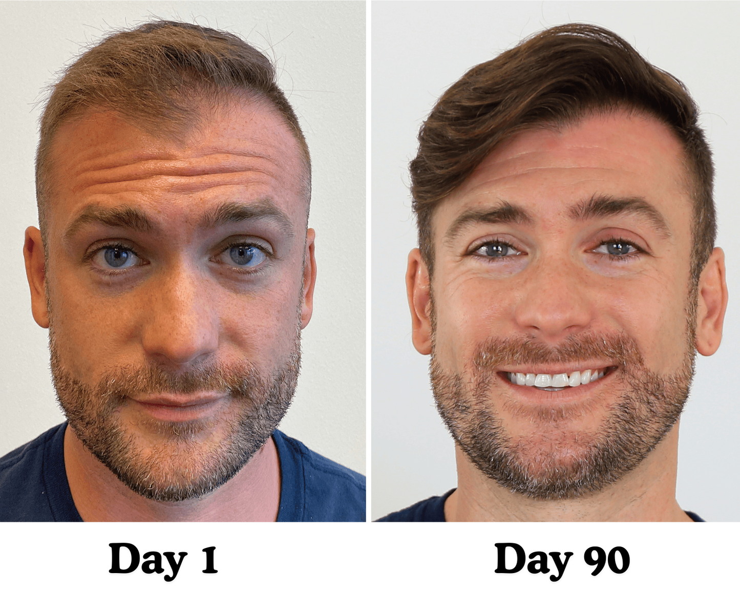 Pumpkin Seed Hair Restore™