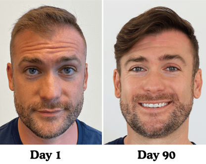 Pumpkin Seed Hair Restore™