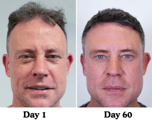 Pumpkin Seed Hair Restore