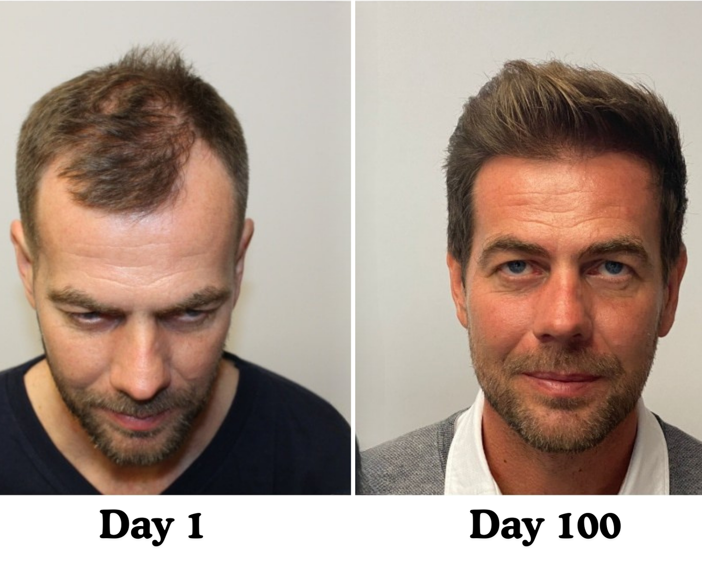 Pumpkin Seed Hair Restore™