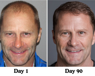 Pumpkin Seed Hair Restore™