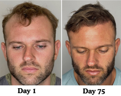 Pumpkin Seed Hair Restore™