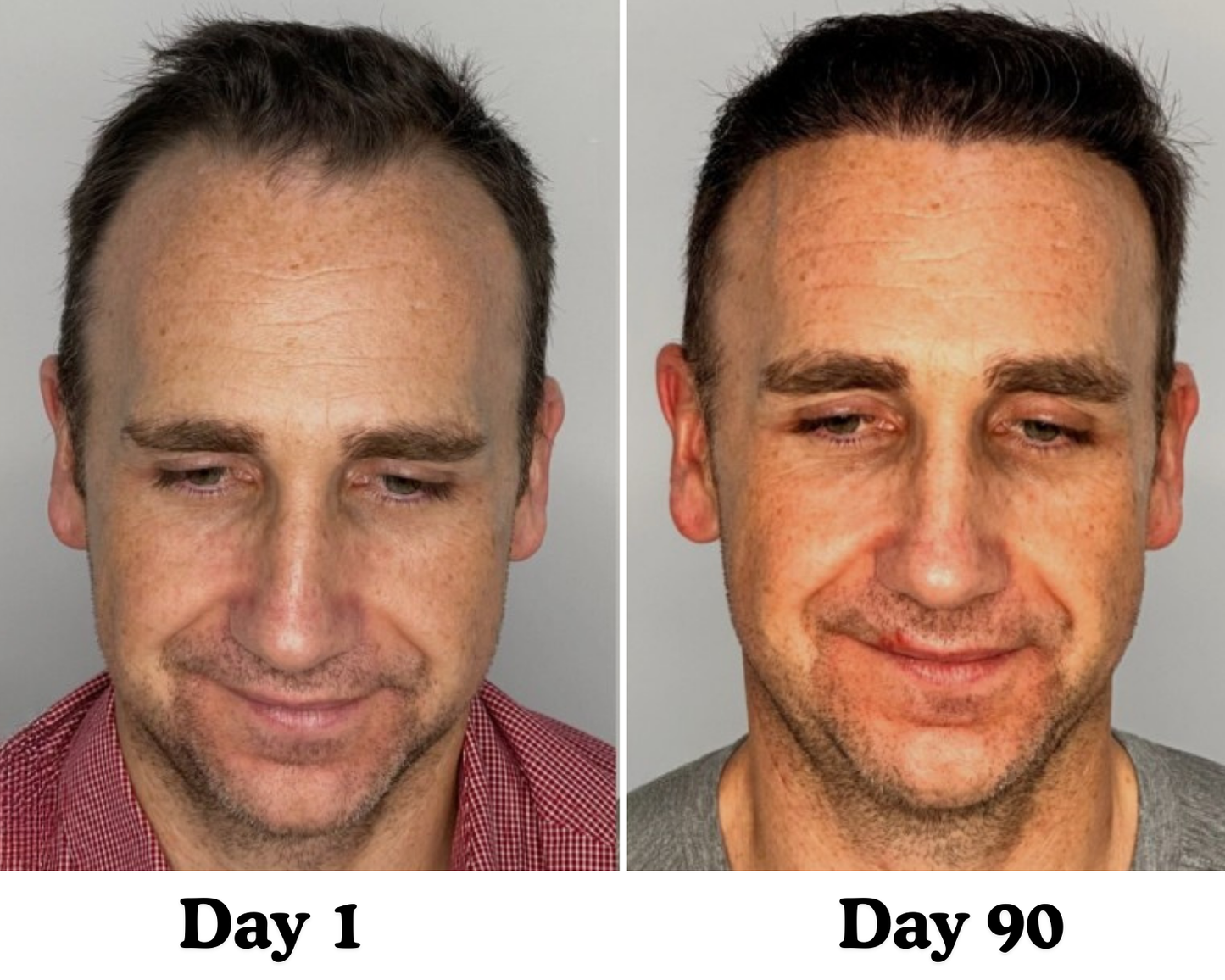 Pumpkin Seed Hair Restore™